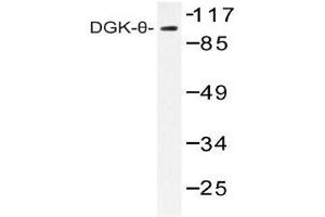 Western blot (WB) analysis of DGK-theta antibody in extracts from HT-29 cells.