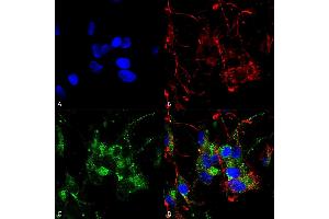 Immunocytochemistry (ICC) image for anti-Hyperpolarization Activated Cyclic Nucleotide-Gated Potassium Channel 2 (HCN2) (AA 761-863) antibody (HRP) (ABIN2481388)