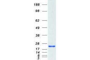 Validation with Western Blot