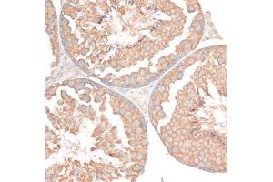 Immunohistochemistry of paraffin-embedded mouse testis using BCL2 antibody (ABIN6291793) at dilution of 1:100 (40x lens).