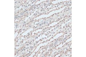 Immunohistochemistry of paraffin-embedded mouse kidney using ZNF597 antibody  at dilution of 1:100 (40x lens). (ZNF597 antibody  (AA 1-140))