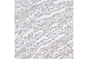 Immunohistochemistry of paraffin-embedded mouse kidney using ZNF597 antibody  at dilution of 1:100 (40x lens). (ZNF597 antibody  (AA 1-140))
