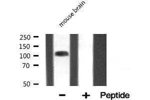 Western blot analysis of EIF4G2 expression in Mouse brain lysate (EIF4G2 antibody  (N-Term))