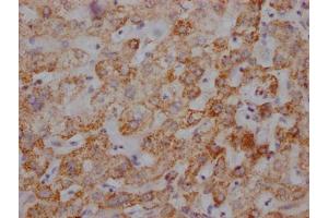 IHC image of ABIN7127865 diluted at 1:100 and staining in paraffin-embedded human liver tissue performed on a Leica BondTM system. (Recombinant UQCRC2 antibody)
