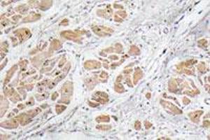 Immunohistochemical staining of paraffin-embedded human heart tissue with GNRH1 polyclonal antibody .