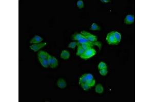 Immunofluorescent analysis of MCF-7 cells using ABIN7149238 at dilution of 1:100 and Alexa Fluor 488-congugated AffiniPure Goat Anti-Rabbit IgG(H+L) (CYP2B6 antibody  (AA 250-343))