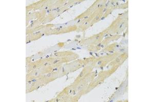 Immunohistochemistry of paraffin-embedded rat heart using TRAP1 Antibody (ABIN1875197) at dilution of 1:100 (40x lens). (TRAP1 antibody)