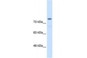 Image no. 1 for anti-Actinin, alpha 4 (ACTN4) (AA 800-849) antibody (ABIN6736629) (alpha Actinin 4 antibody  (AA 800-849))