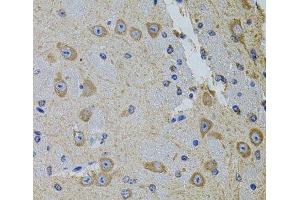 Immunohistochemistry of paraffin-embedded Mouse brain using Gm13125 Polyclonal Antibody at dilution of 1:100 (40x lens). (Pramel15 antibody)