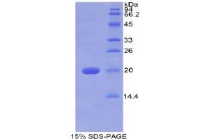SDS-PAGE analysis of Human Galactosylceramidase Protein.