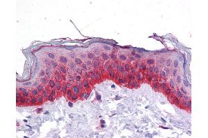 Immunohistochemistry (IHC) image for anti-Bone Morphogenetic Protein 7 (BMP7) (N-Term) antibody (ABIN2779568) (BMP7 antibody  (N-Term))