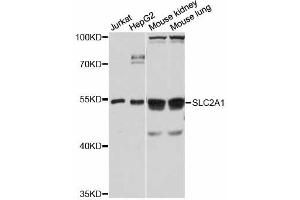 Western blot analysis of extracts of various cell lines, using SLC2A1 antibody. (GLUT1 antibody)