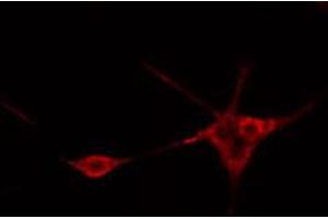 ABIN6269113 staining Hela cells by IF/ICC. (Ret Proto-Oncogene antibody  (C-Term))