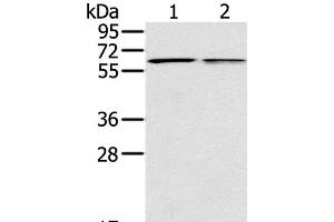 Western Blot analysis of Mouse liver and lung tissue using PTGER2 Polyclonal Antibody at dilution of 1:200 (PTGER2 antibody)