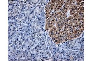 Immunohistochemical staining of paraffin-embedded Kidney tissue using anti-TTLL12mouse monoclonal antibody. (TTLL12 antibody)
