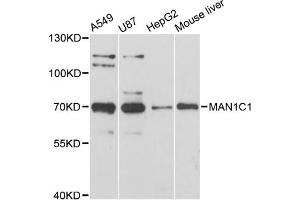 Western blot analysis of extracts of various cell lines, using MAN1C1 antibody (ABIN6292826) at 1:3000 dilution.