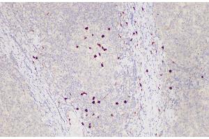 Immunohistochemistry of paraffin-embedded Human tonsil using S100A12 Polycloanl Antibody at dilution of 1:85 (S100A12 antibody)