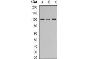 Western blot analysis of Dynamin 1 expression in NIH3T3 (A), mouse brain (B), PC12 (C) whole cell lysates. (Dynamin 1 antibody  (C-Term))