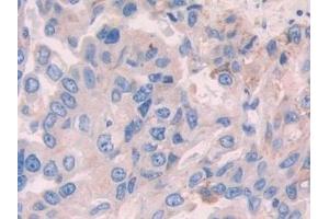 Immunohistochemistry (IHC) image for anti-Alcohol Dehydrogenase 1 (Class I) (ADH1) (AA 169-370) antibody (ABIN7432379)