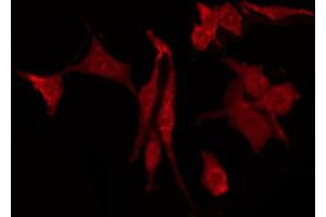 ABIN6274407 staining HepG2 by IF/ICC. (DOK3 antibody  (Internal Region))