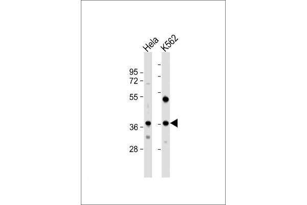 CTDSPL antibody  (N-Term)