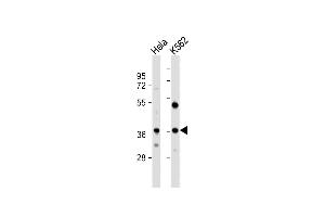 All lanes : Anti-CTDSPL Antibody (N-term) at 1:1000 dilution Lane 1: Hela whole cell lysate Lane 2: K562 whole cell lysate Lysates/proteins at 20 μg per lane. (CTDSPL antibody  (N-Term))