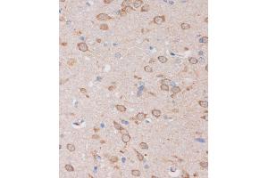 Immunohistochemistry of paraffin-embedded Rat brain using STIM2 Rabbit pAb (ABIN7270611) at dilution of 1:100 (40x lens). (Stim2 antibody  (AA 60-180))