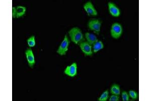 Immunofluorescent analysis of A549 cells using ABIN7150558 at dilution of 1:100 and Alexa Fluor 488-congugated AffiniPure Goat Anti-Rabbit IgG(H+L) (DNAJC4 antibody  (AA 1-155))