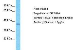 Host: Rabbit Target Name: GPR89A Sample Type: Fetal Brain lysates Antibody Dilution: 1. (GPR89A antibody  (C-Term))