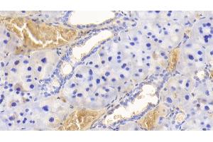 Detection of HB in Rat Adrenal gland Tissue using Polyclonal Antibody to Hemoglobin (HB) (Hemoglobin antibody)