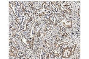 IHC analysis of Methylmalonyl Coenzyme A using anti-Methylmalonyl Coenzyme A antibody (ABIN7603112). (MUT antibody  (N-Term))