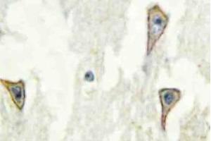 Immunohistochemistry (IHC) analyzes of A Cyclase I antibosy in paraffin-embedded human brain tissue. (ADCY1 antibody)