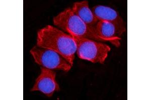 IF analysis of MOV10 using anti-MOV10 antibody (ABIN7600236). (MOV10 antibody  (AA 167-772))