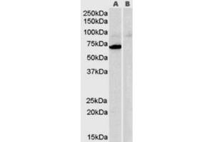Western Blotting (WB) image for anti-Monoamine Oxidase A (MAOA) (Internal Region) antibody (ABIN2465953) (Monoamine Oxidase A antibody  (Internal Region))