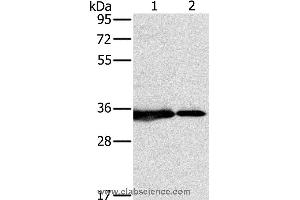 Western blot analysis of 231 and Jurkat cell, using NDUFAF1 Polyclonal Antibody at dilution of 1:500 (NDUFAF1 antibody)