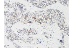 Immunohistochemistry (IHC) image for anti-Nephroblastoma Overexpressed (NOV) antibody (ABIN2474328) (NOV antibody)