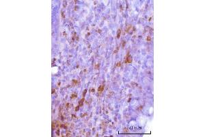IHC analysis of Cdk2 using anti-Cdk2 antibody (ABIN7602523). (CDK2 antibody  (AA 81-298))