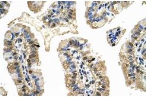 Immunohistochemical staining (Formalin-fixed paraffin-embedded sections) of human intestine with MCM8 polyclonal antibody  at 4-8 ug/mL working concentration. (MCM8 antibody  (C-Term))