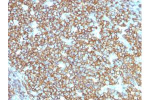 Immunohistochemistry (IHC) image for anti-Membrane-Spanning 4-Domains, Subfamily A, Member 1 (MS4A1) antibody (ABIN5583809)