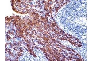 Immunohistochemistry (IHC) image for anti-Keratin 19 (KRT19) (C-Term) antibody (ABIN870575) (Cytokeratin 19 antibody  (C-Term))