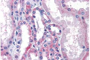 Kidney, Human: Formalin-Fixed, Paraffin-Embedded (FFPE) (LPCAT1 antibody  (Internal Region))