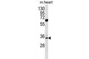 Western Blotting (WB) image for anti-Zinc Finger Protein 146 (ZNF146) antibody (ABIN5016317) (ZNF146 antibody)