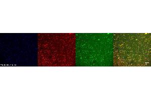 Immunohistochemistry (IHC) image for anti-Platelet Derived Growth Factor Receptor beta (PDGFRB) antibody (ABIN7456120) (PDGFRB antibody)