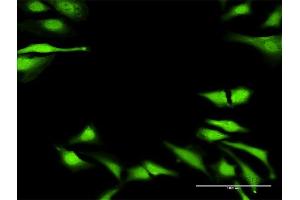 Immunofluorescence of purified MaxPab antibody to DUSP23 on HeLa cell. (DUSP23 antibody  (AA 1-150))