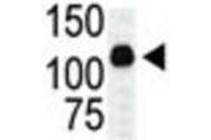 Western Blotting (WB) image for anti-Mitogen-Activated Protein Kinase Kinase Kinase 10 (MAP3K10) antibody (ABIN3003575)