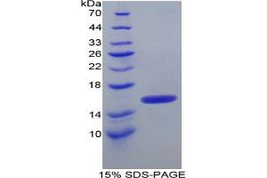 SDS-PAGE of Protein Standard from the Kit  (Highly purified E. (ITIH4 ELISA Kit)