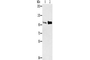 Western Blotting (WB) image for anti-Actinin, alpha 2 (ACTN2) antibody (ABIN2427122) (ACTN2 antibody)
