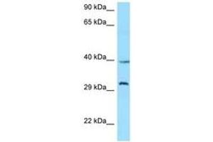 Image no. 1 for anti-Growth Hormone Secretagogue Receptor (GHSR) (C-Term) antibody (ABIN6748194) (GHSR antibody  (C-Term))