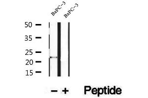 Western blot analysis of extracts of BxPC-3 cells, using REEP6 antibody. (REEP6 antibody  (C-Term))