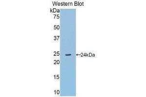 Western Blotting (WB) image for anti-Angiotensinogen (serpin Peptidase Inhibitor, Clade A, Member 8) (AGT) (AA 155-355) antibody (ABIN3207840)